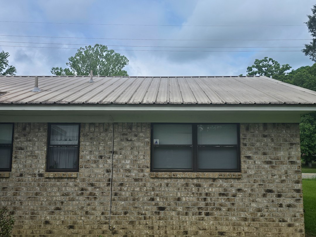 52 year old home facelift